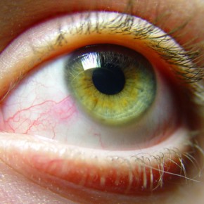 Красные глаза: 10 причин